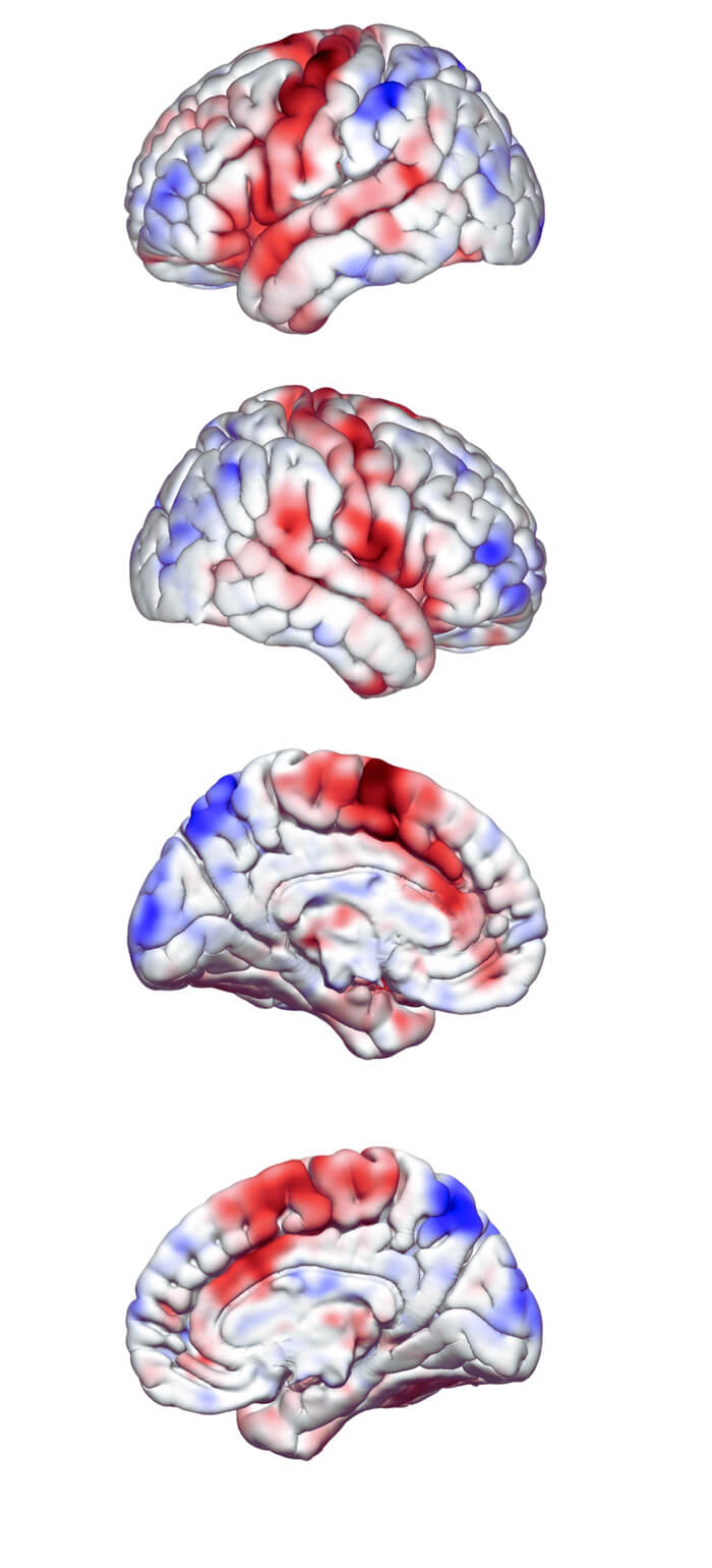 Resting state network connectivity map