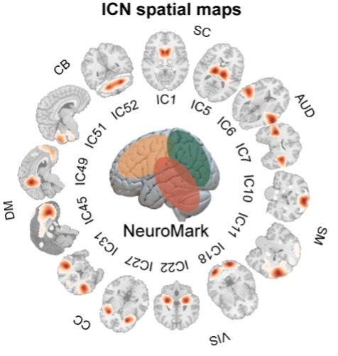 Image from brain research study