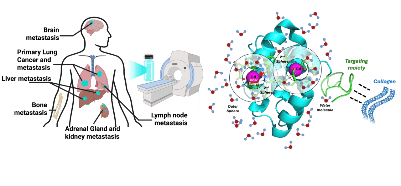 Image showing locations where tumors may mestatasize to from the lungs
