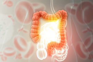 Metabolite-Inspired Compounds Show Promise for Ulcerative Colitis Drug Discovery, Study Finds