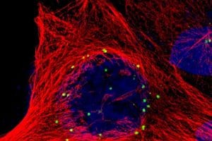 When Cell Division Goes Wrong