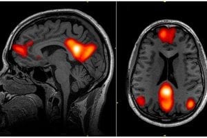 Researchers Create Math Model For Understanding Brain Activity, Complex Data
