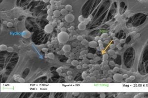 Researchers Get $1.4 Million To Study Treatments For Intestinal Inflammation