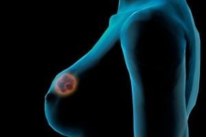 Breast cancer conference creates new community of researchers