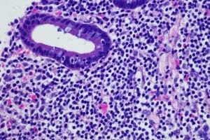 Researchers Develop Test That Can Diagnose Two Cancer Types