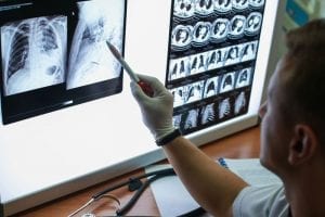 Autoimmunity Plays Role In Development Of COPD, Study Finds