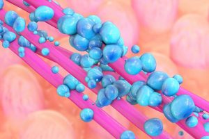 Minimally Invasive Screening Using Infrared Technology Could Offer Fast, Simple Test for Colitis