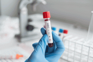 Problem Drinking Linked To HIV, Other Sexually Transmitted Infections In Ugandan Youth, Study Finds