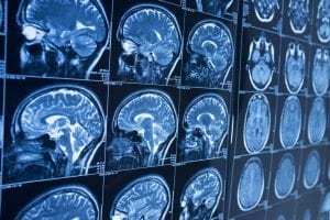 Difficult Decisions Involving Perception Increase Activity in Brain’s Insular Cortex, Study Finds