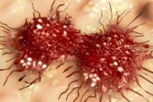 New Biomarkers May Influence Drug Design and Alternative Treatments of Cancer, Study Shows