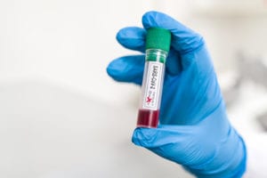 Georgia State Researchers Survey Antibodies to SARS-CoV-2 in Blood Samples of Local Residents