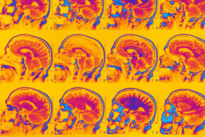 International Brain Imaging Contest Advances Mental Illness Research