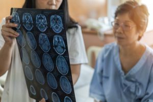 Georgia State Researcher Receives $3.5 Million To Study Brain Dynamics in Alzheimer’s Disease