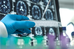 GSU Study Examines Perceptions of Benefits and Risks of Data Sharing in Dementia Research